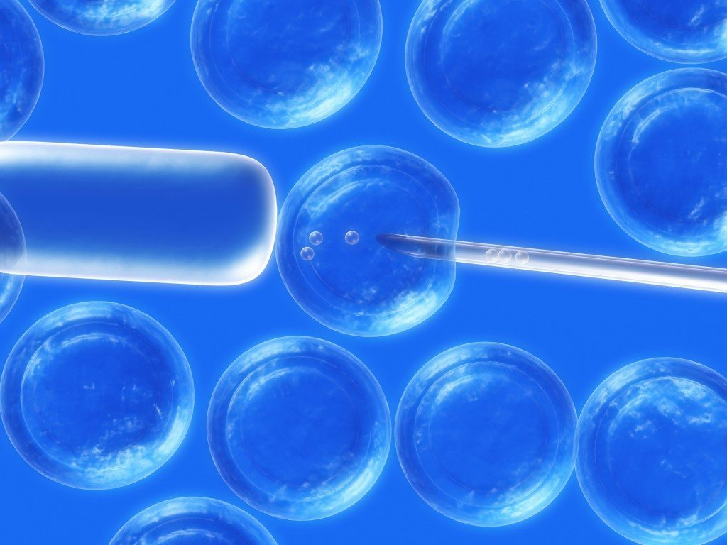 Prelevare celule stem