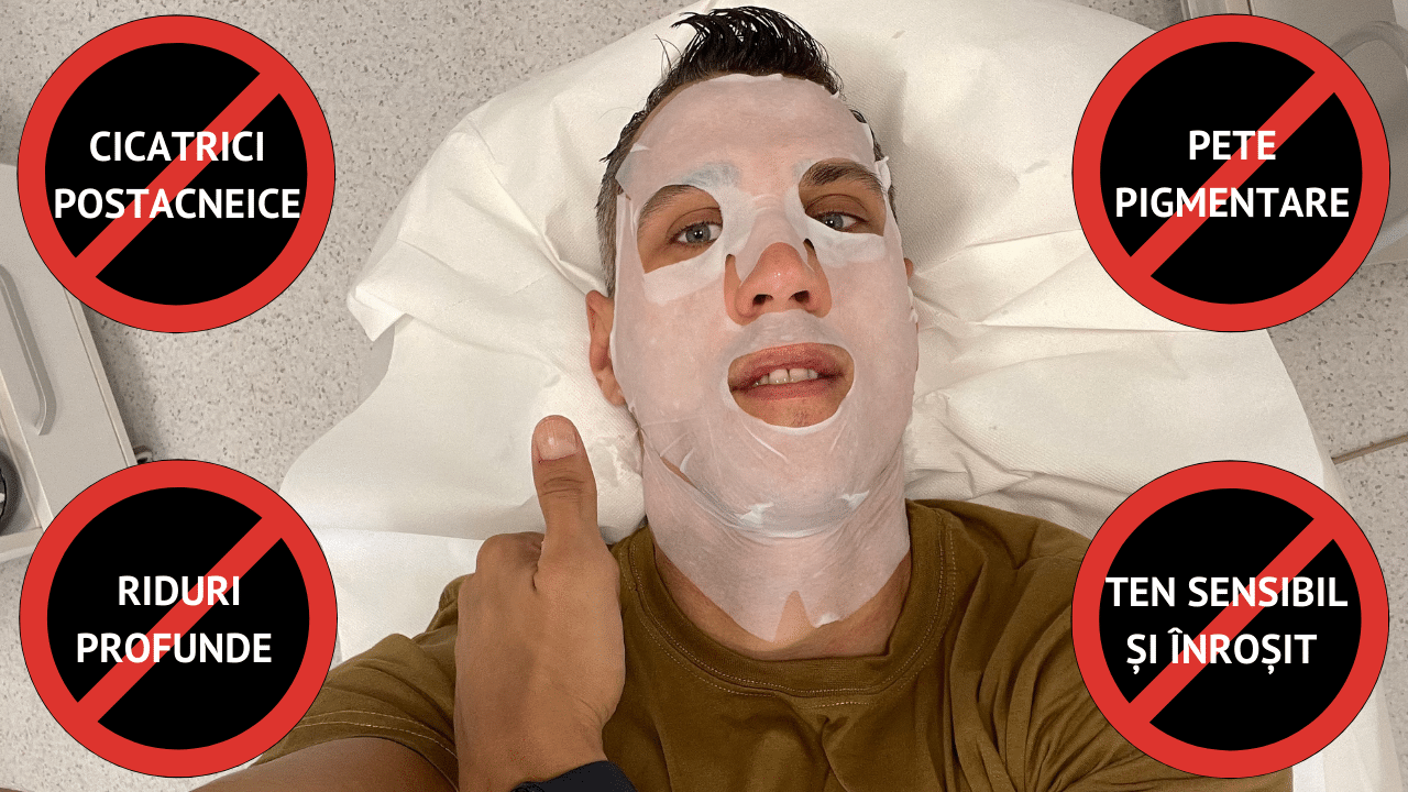 Tratament Facial Antirid, Întinerire, Cicatrici Postacneice și Fermitate cu SPN6 la aBeauty Clinique